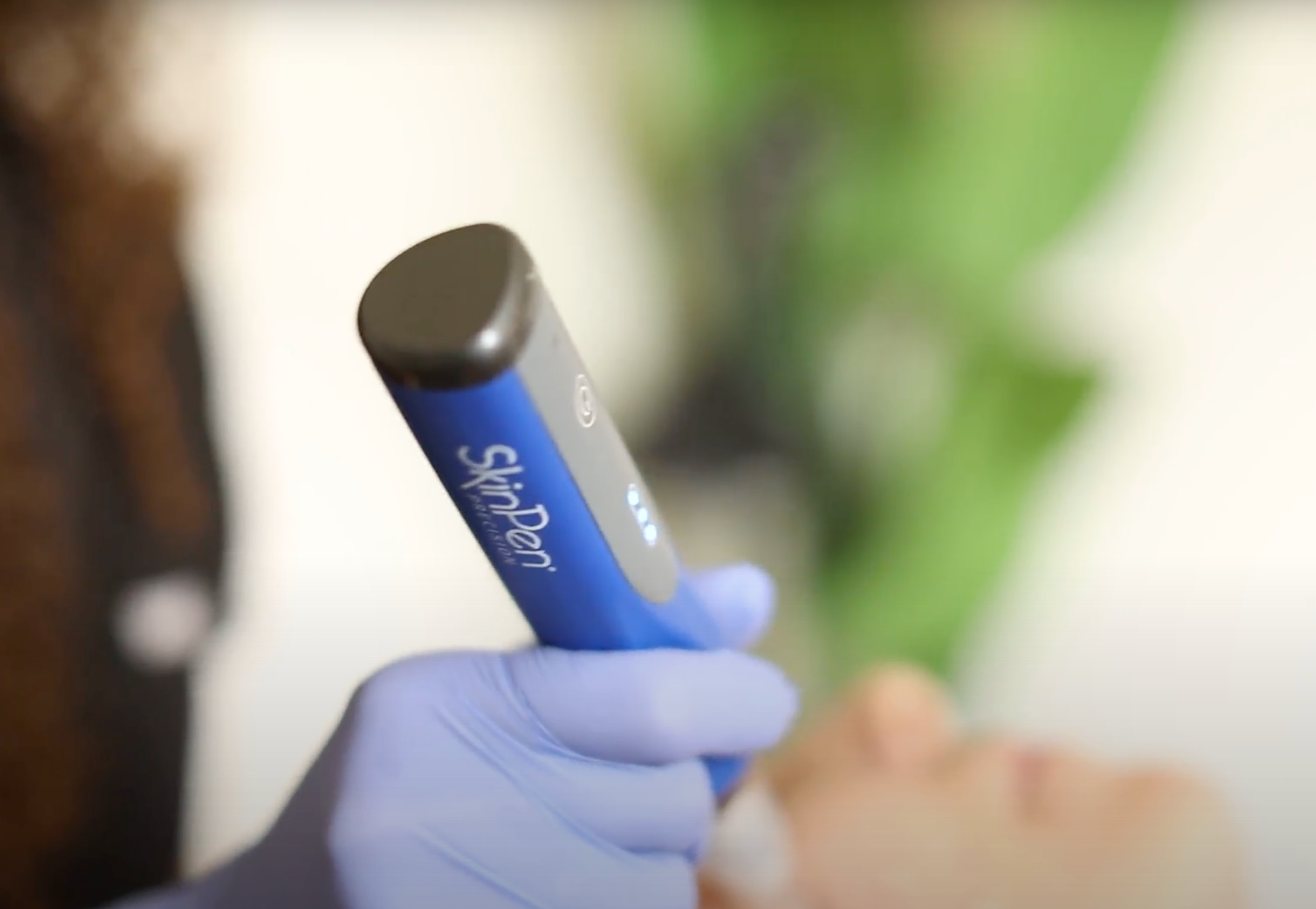 What You Should Know About Microneedling