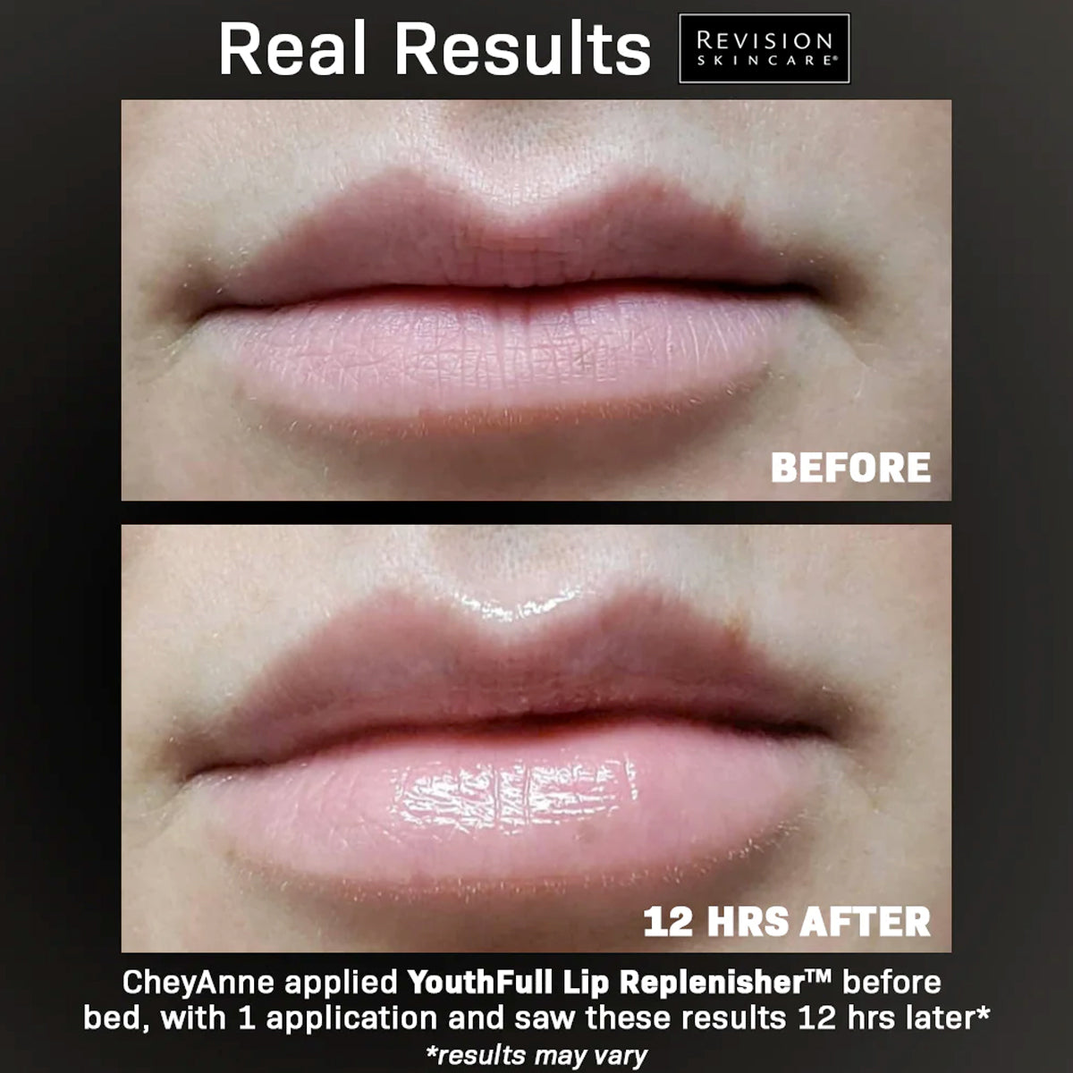 Image showing real results of YouthFull Lip Replenisher® 0.33 oz. before and after 12 hours of use.